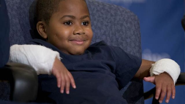 July 28, 2015: Double-hand transplant recipient eight-year-old Zion Harvey smiles during a news conference at The Children's Hospital of Philadelphia. Surgeons said Harvey, who lost his limbs to a serious infection, has become the youngest patient to receive a double-hand transplant. (AP Photo/Matt Rourke)